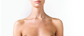 Breast Augmentation Breast Augmentation