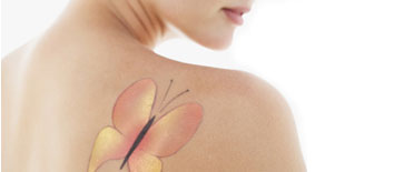 Tattoo Removal Tattoo Removal